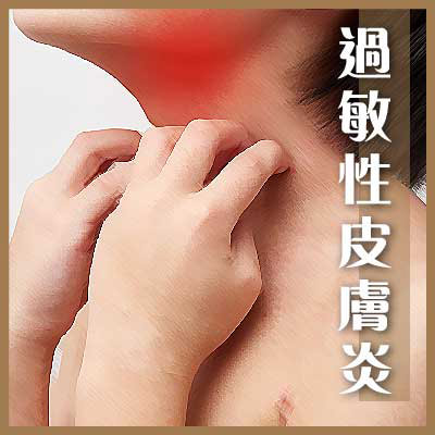 过敏性皮肤炎